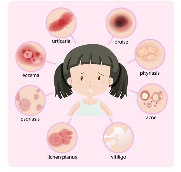 دکتر نعمت الله کهندانی : نام بیماری ها به انگلیسی