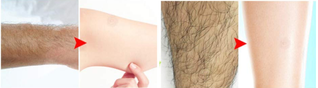 دکتر نعمت الله کهندانی : کرم‌های موبر از محصولات رایج برای حذف موی زائد بدن هستند