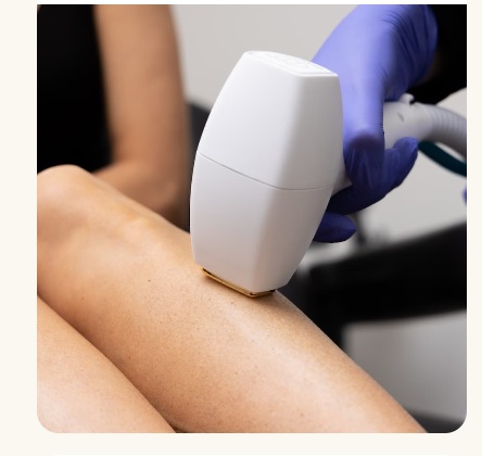 لیزر موهای زائد