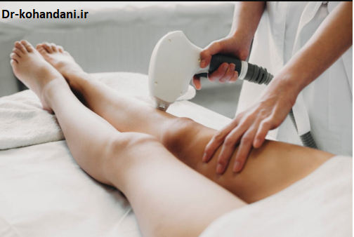 دکتر نعمت الله کهندانی : در زمینه موهای زائد و استفاده از لیزر برای رفع آنها